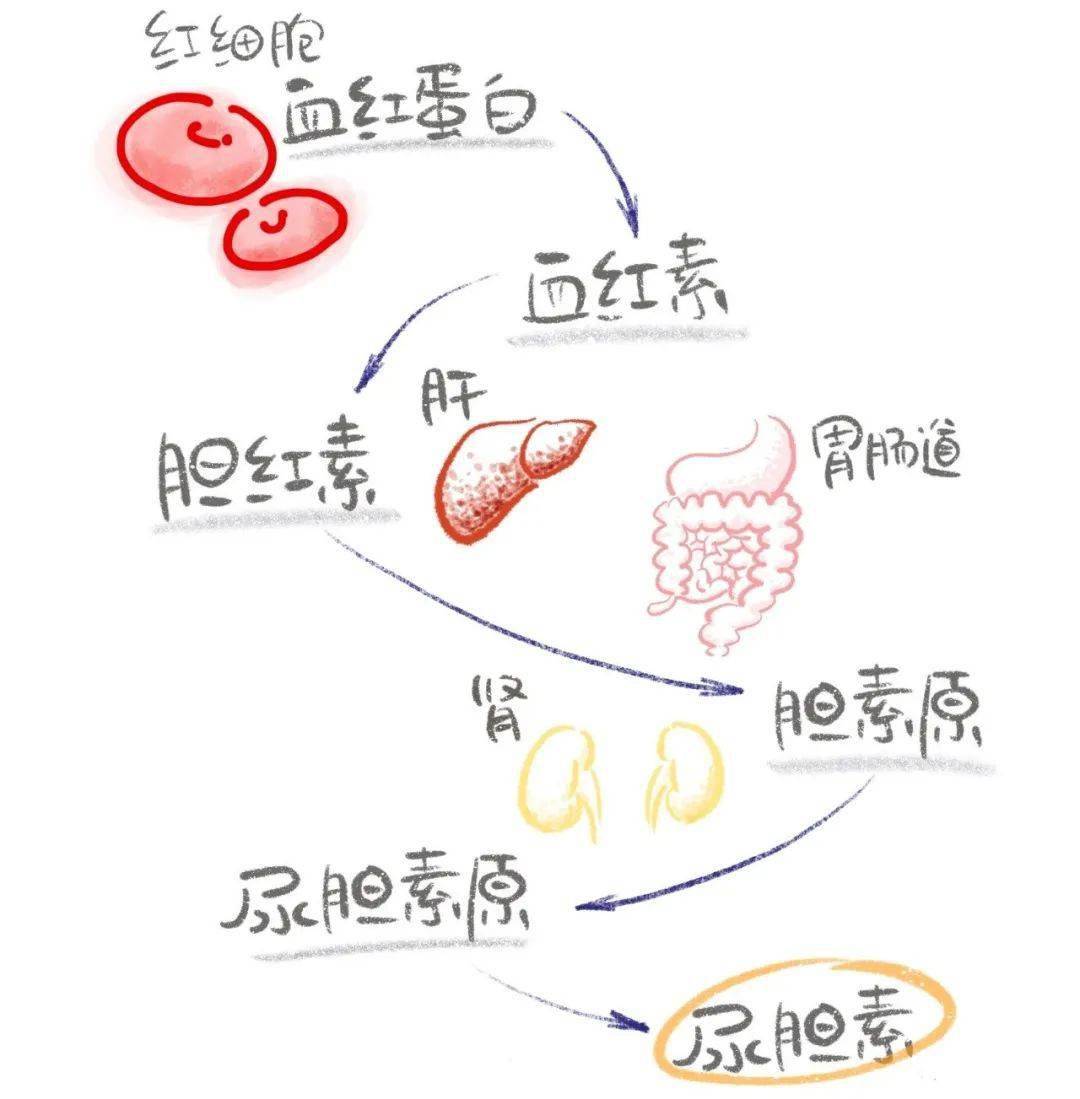 胆红素的代谢途径图片