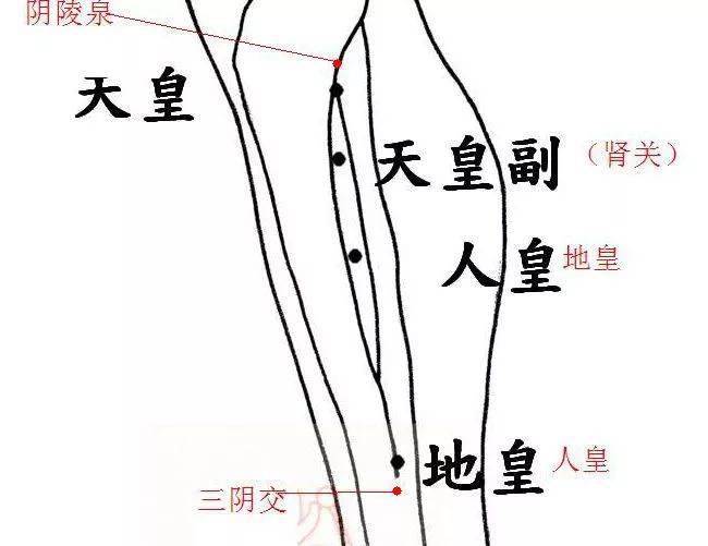 7,下三皇治糖尿病針法與應用:針深五分至一寸