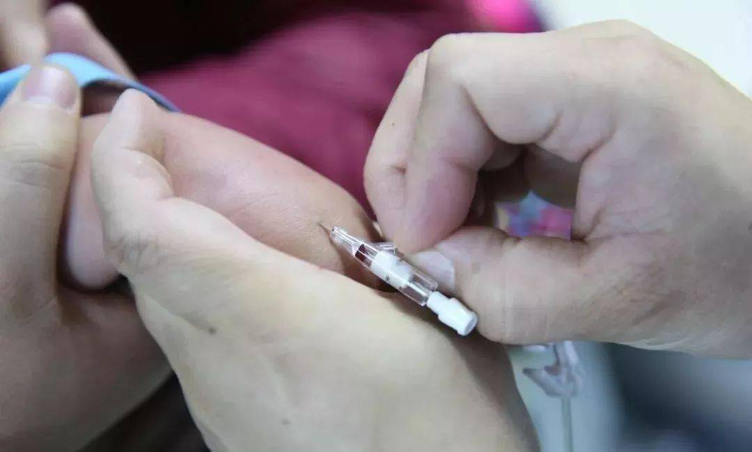 左手不动,右手继续将套管推入血管