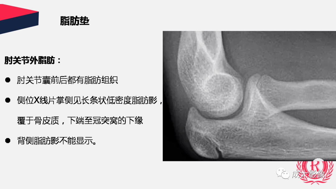 儿童肘关节x片骨骺图片