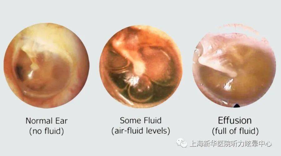 來看看,兒童最常出現的耳部問題有哪些_手機搜狐網