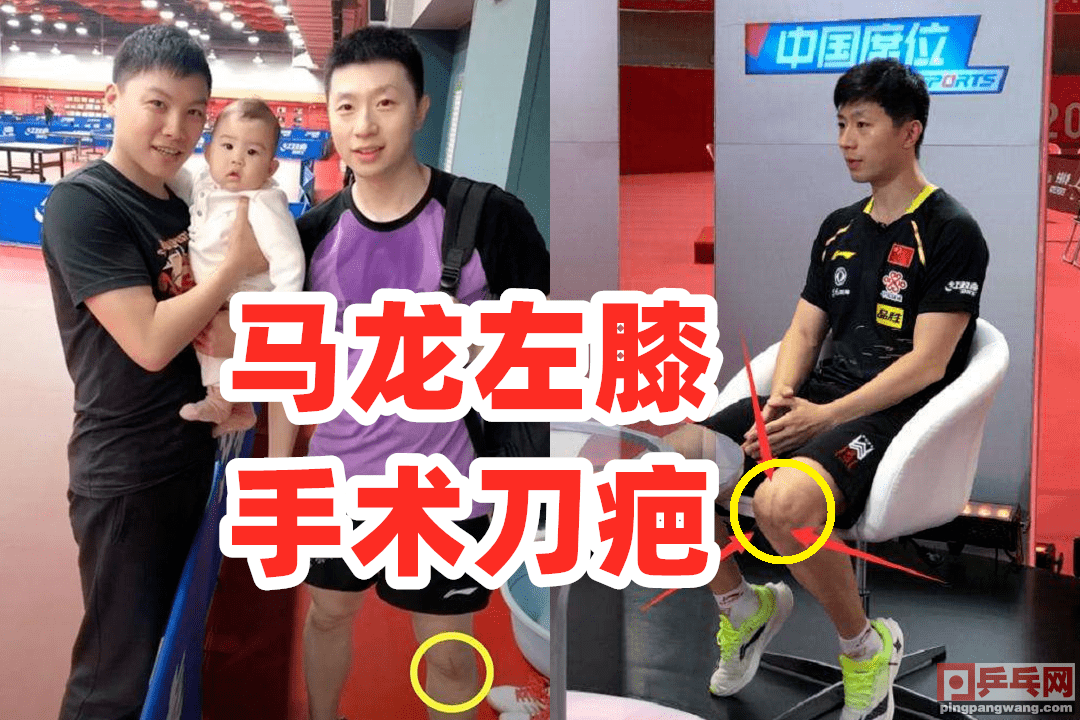 国乒马龙恐被左膝拖累全锦赛名单难出先过体测关能否网开一面