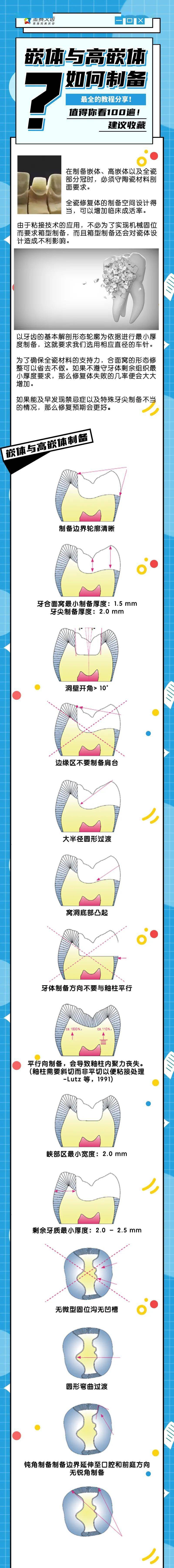 最全教程嵌体与高嵌体制备建议收藏