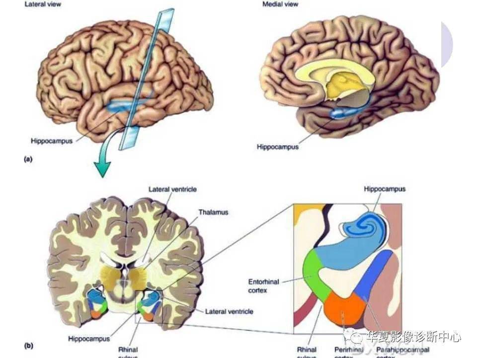 大鼠海马位置图片