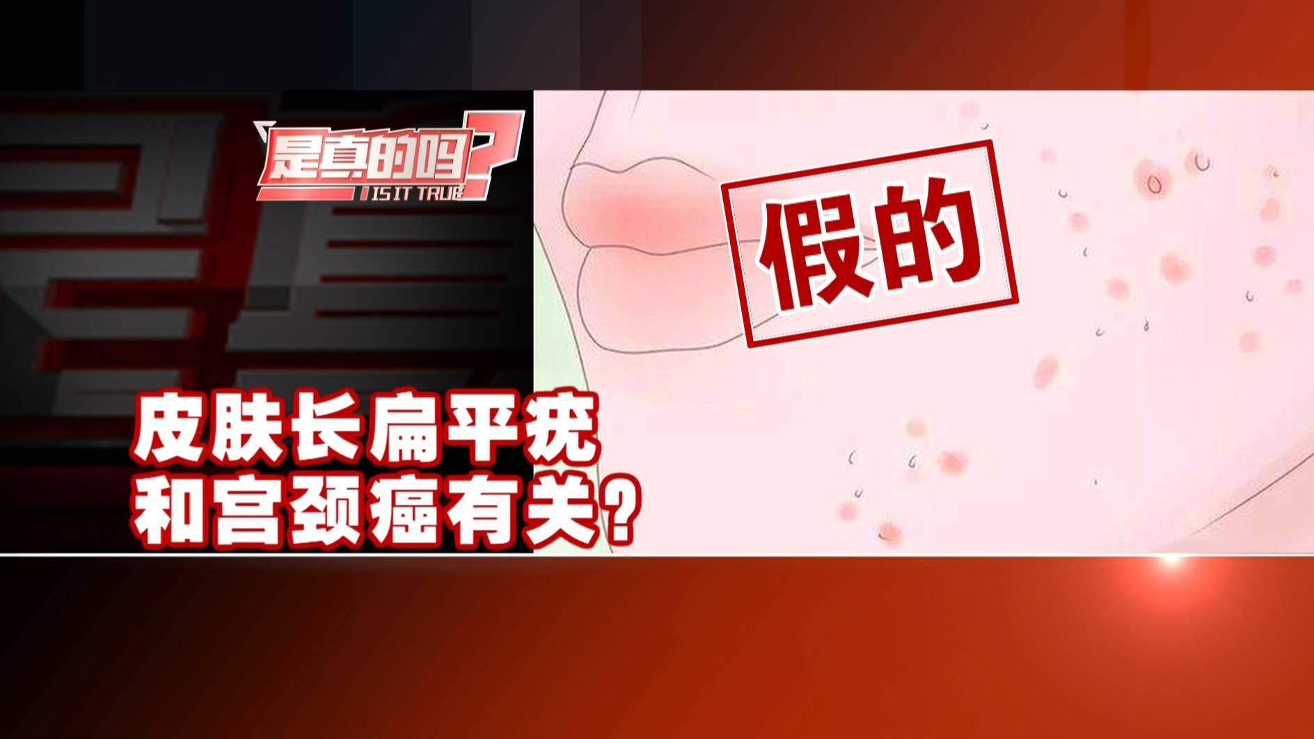 扁平疣與宮頸癌都是hpv病毒感染導致的長了扁平疣宮頸癌就來了速看