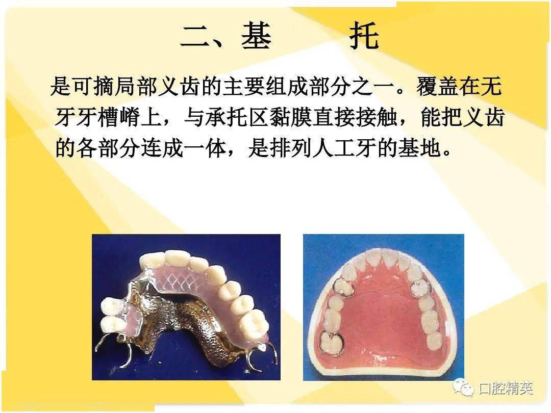 假牙结构图图片