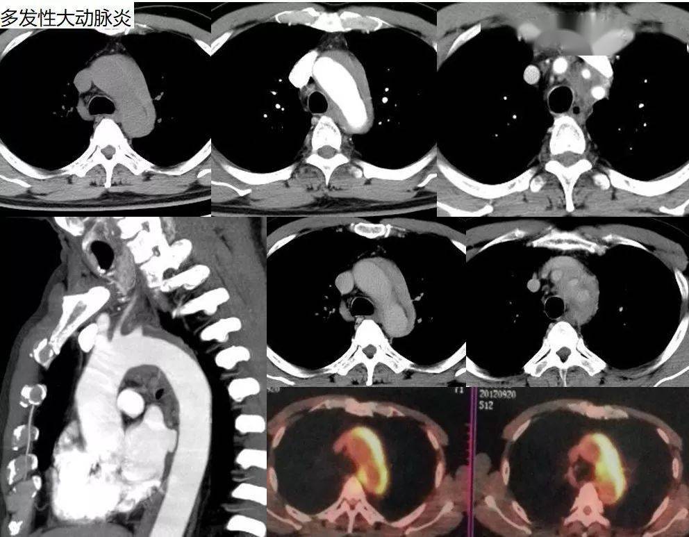 核磁共振成像(mri)