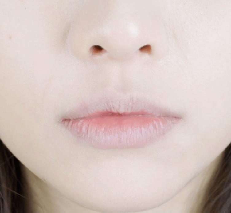 唇干又易甩皮3个护唇小贴士让你摆脱唇部干裂