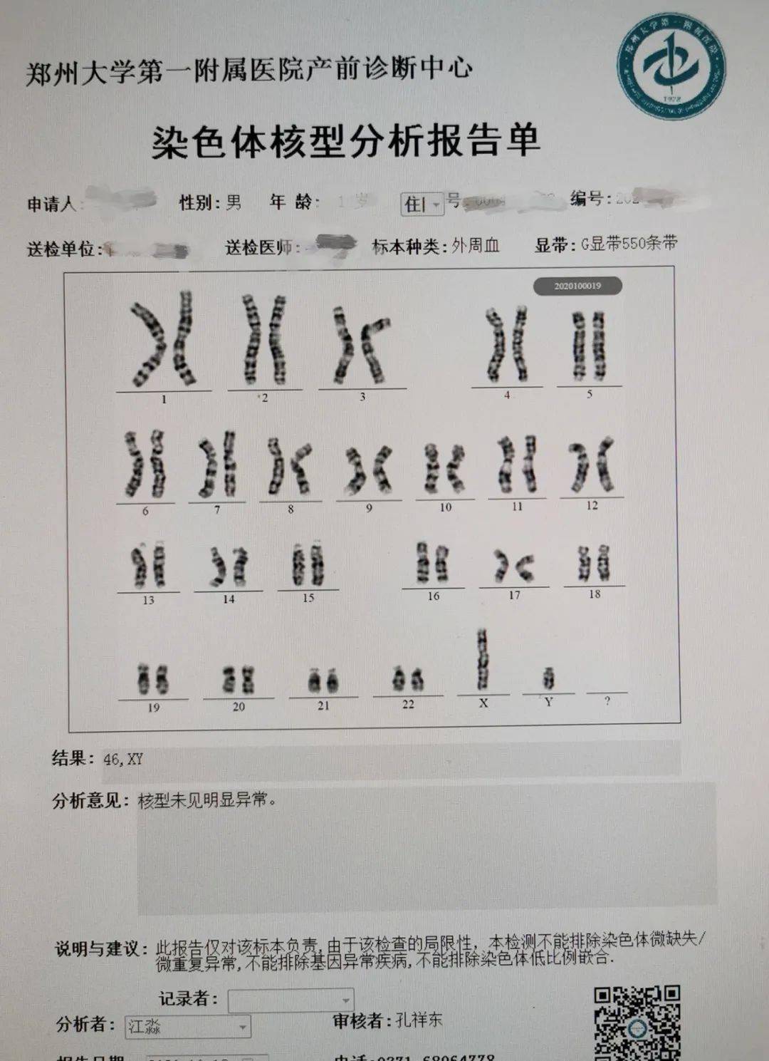 染色体核型分析报告图片