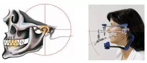 面弓与颌架简介说明,颌学不可少的伙伴