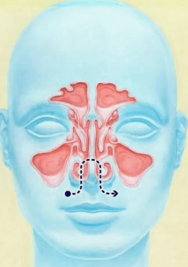 科普一分鐘 | 鼻孔千萬不要隨便摳_鼻腔