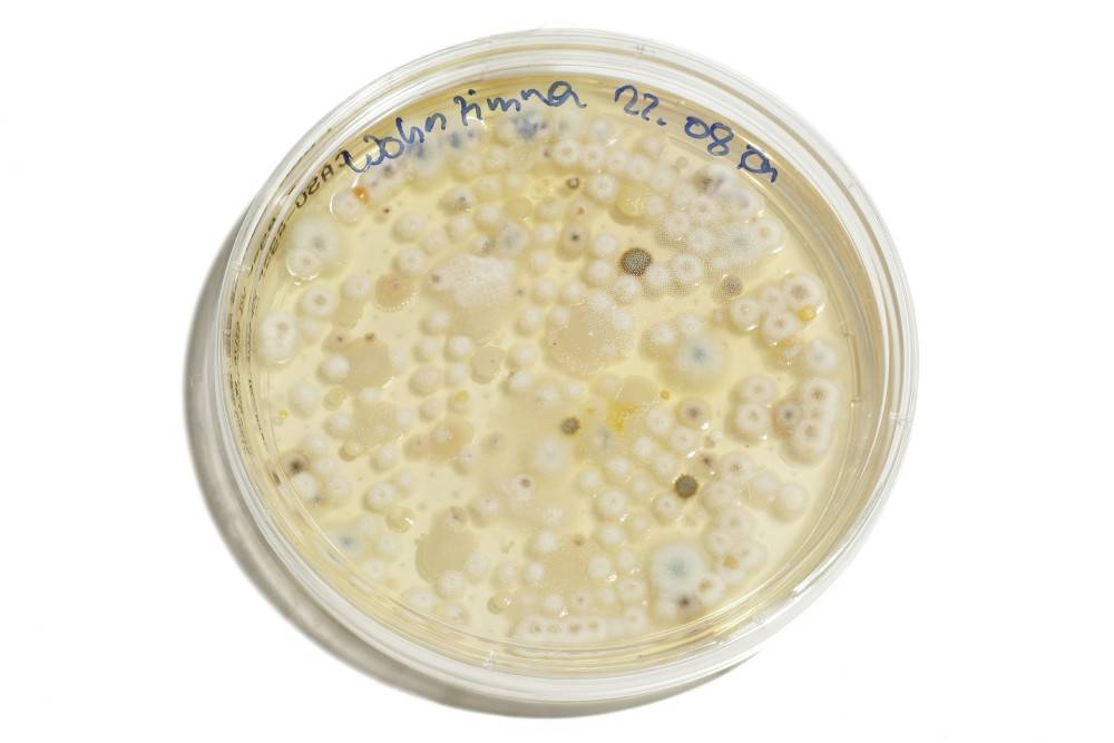 冰箱冻不死费水煮不掉也不是黄曲霉素却吃死7人米酵菌酸咋这么毒