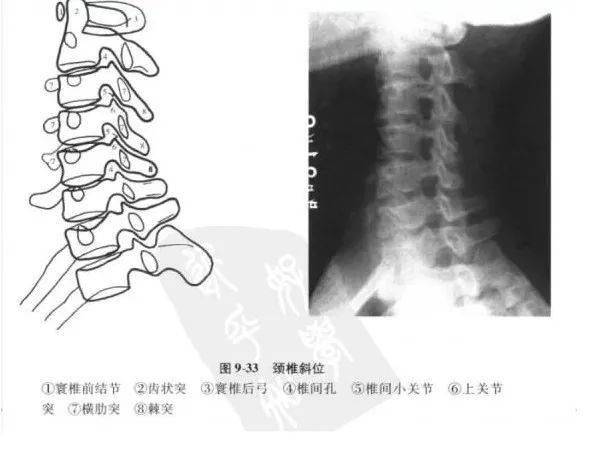 棘突是否居中,排列有無側彎及其他異常;第7頸椎雙側橫突是否