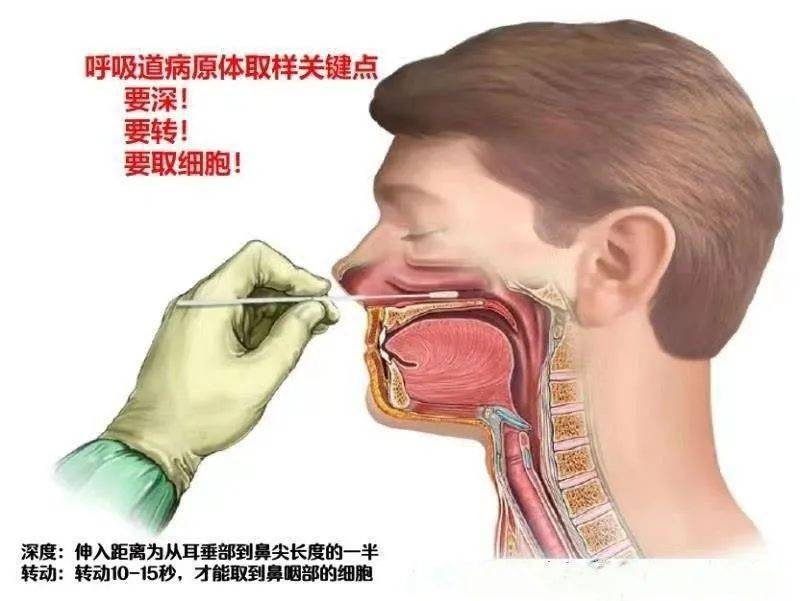新华医院崇明分院预检预约及核酸检测最新通告_采样