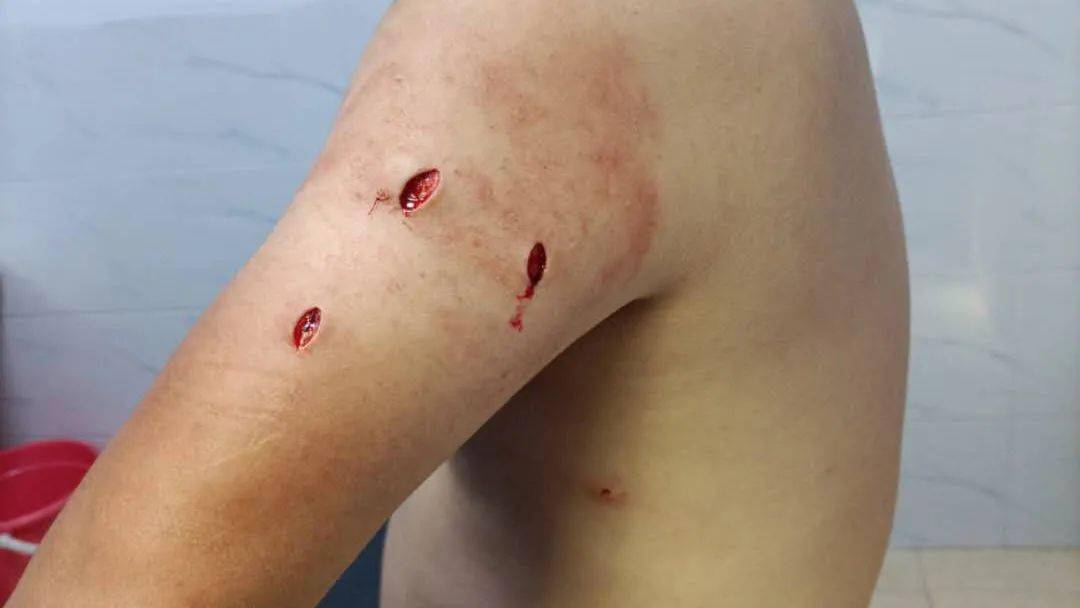 泸州一男子办离婚带刀家暴妻子还刺伤及亲人结果