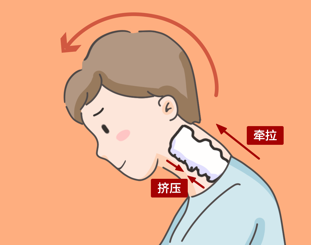 頸椎由7塊頸椎骨縱向構成,呈前凸後凹的c字形,負責起支撐頭部的作用.