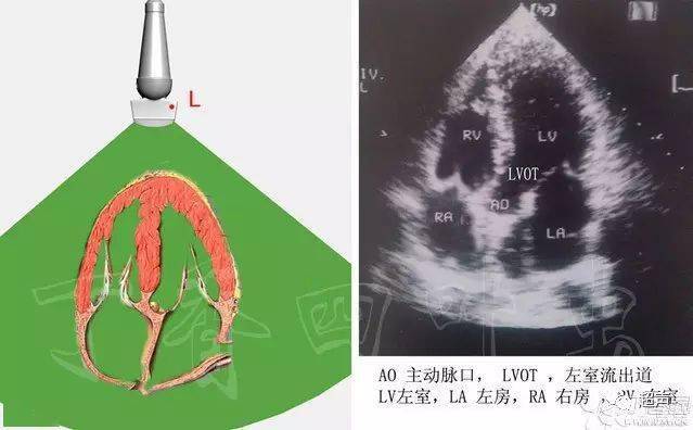 3d圖解心臟解剖與心臟超聲切面