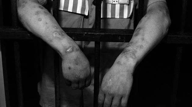 禁毒诗歌惠农区找回真正的自己