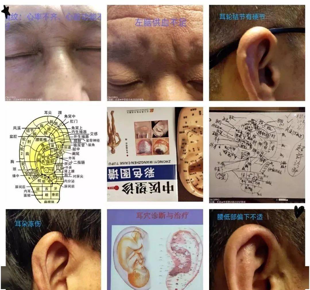 新中醫望診特色診療暨新四診手診面診眼診耳診精修班