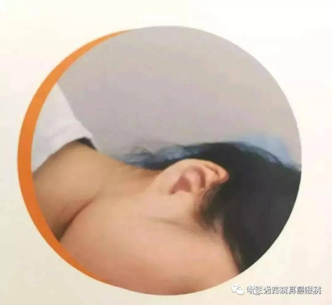 耳浴就是给耳朵洗个澡吗?