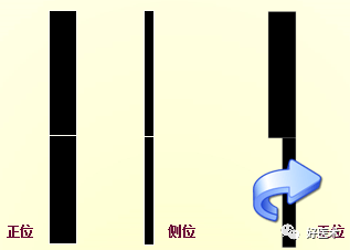 x线基础 | 骨关节x线片,读完这篇快速掌握!_移位