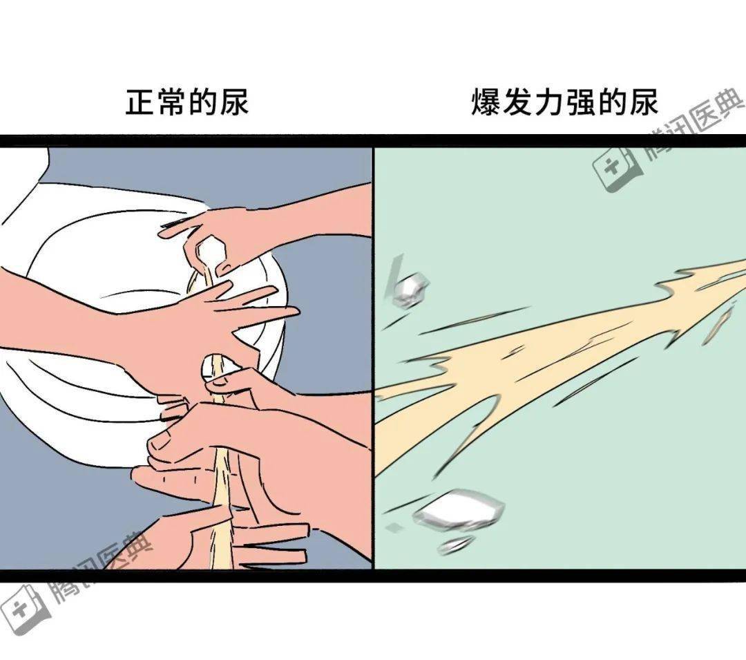 早上起来尿里有泡沫又臭又黄是肾功能出问题了吗