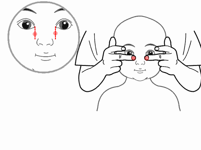 病毒引起,由于鼻咽部是最初感染的部位,因此,鼻部按摩能有效预防感冒