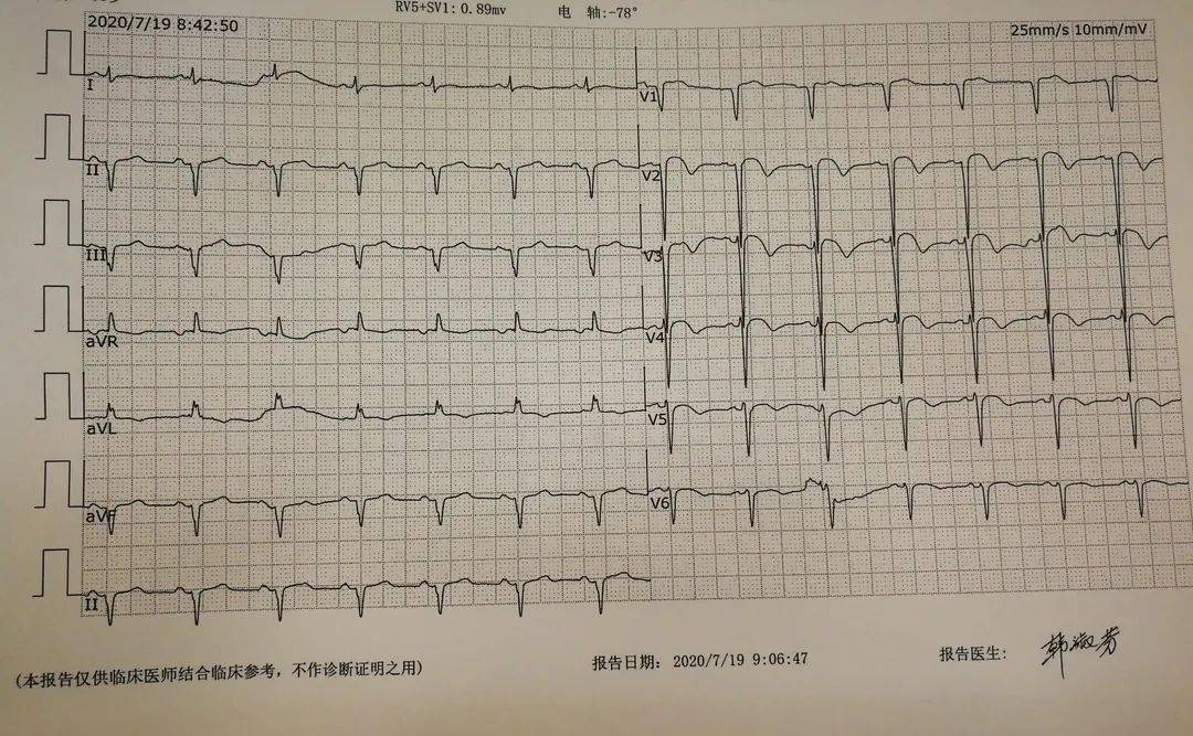 术后心电图胸痛中心打通"救心高速路",一次次把这些已和死神"会面"的