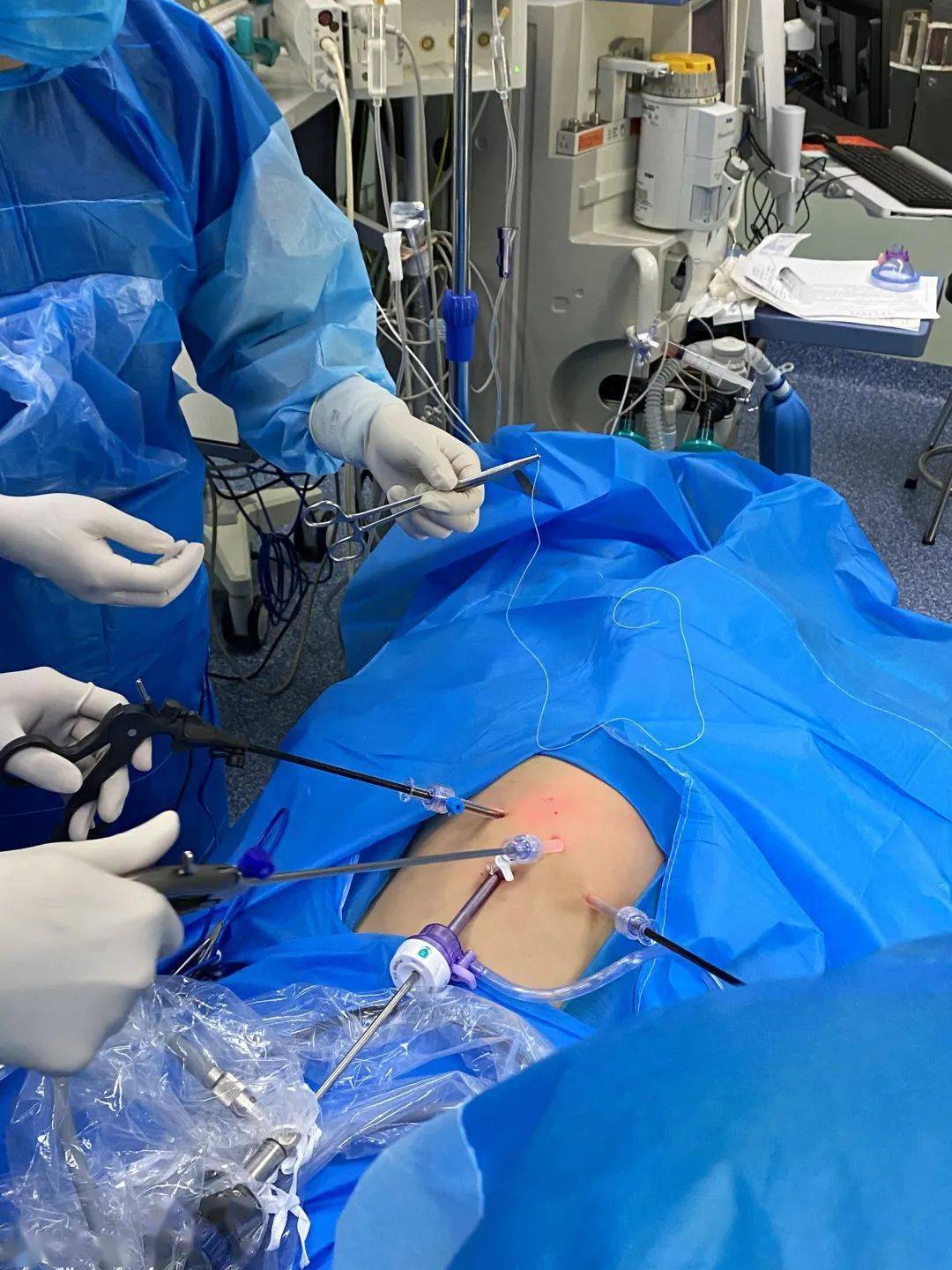 在"感冒"拍胸片时,行上消化道造影检查发现疝入胸腔的器官为"结肠"