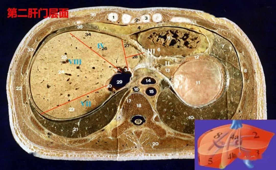 收藏丨肝脏分叶分段的影像解剖