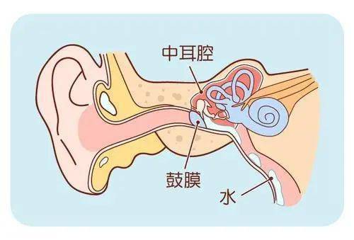幼童中耳炎致鼓膜穿孔,儿童反复感冒发烧要当心