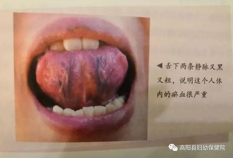 舌下伞襞图片图片