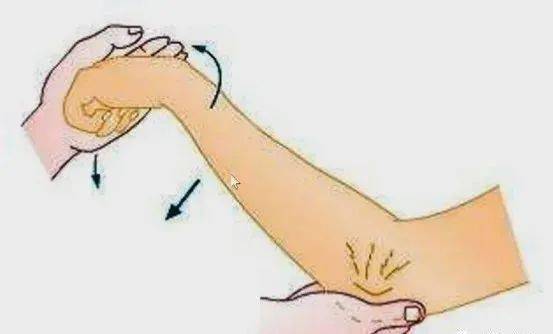 "网球肘"的来龙去脉_前臂