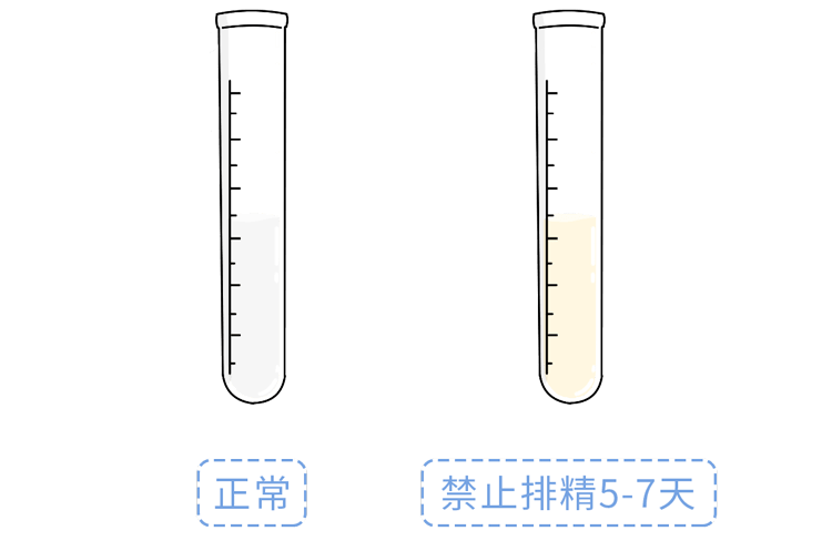 如精液呈白色或略带黄绿色表明生殖道内有炎症可能是前列腺或精囊化脓