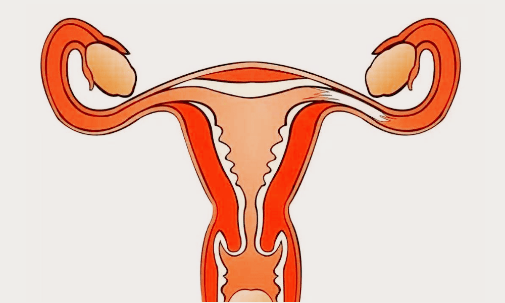 (如:滴虫性阴道炎,念珠菌阴道炎,细菌性阴道炎或宫颈炎等)治疗不及时