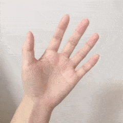 握拳捏圆上下转腕左右相抗手腕屈伸6尺骨撞击综合征在临床上并非罕见