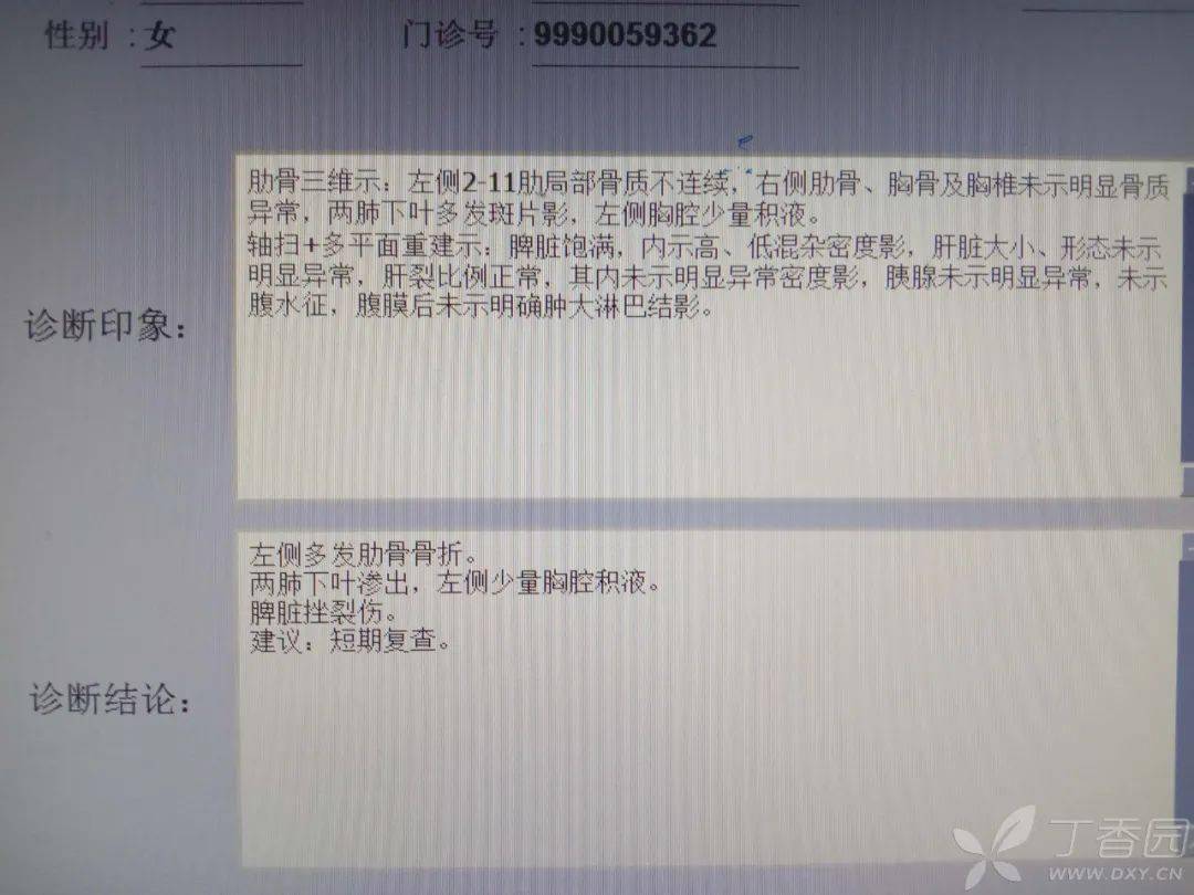 典型迟发性脾破裂,如何治疗?