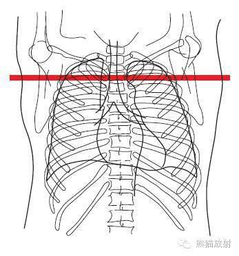 收藏!精美详细的胸部ct断层解剖图(双语)