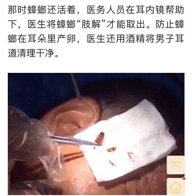 好惨一男的广东男子半夜被蟑螂钻进耳朵耳膜被咬破