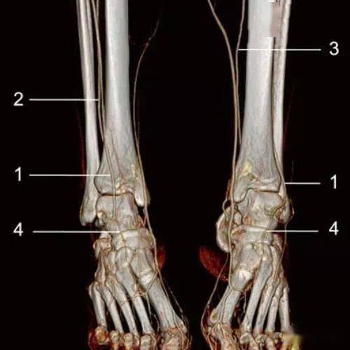 下肢动脉解剖图谱CT图片