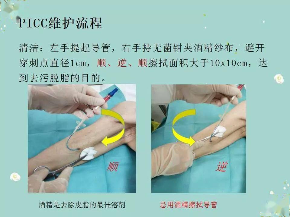 picc维护手册图片图片