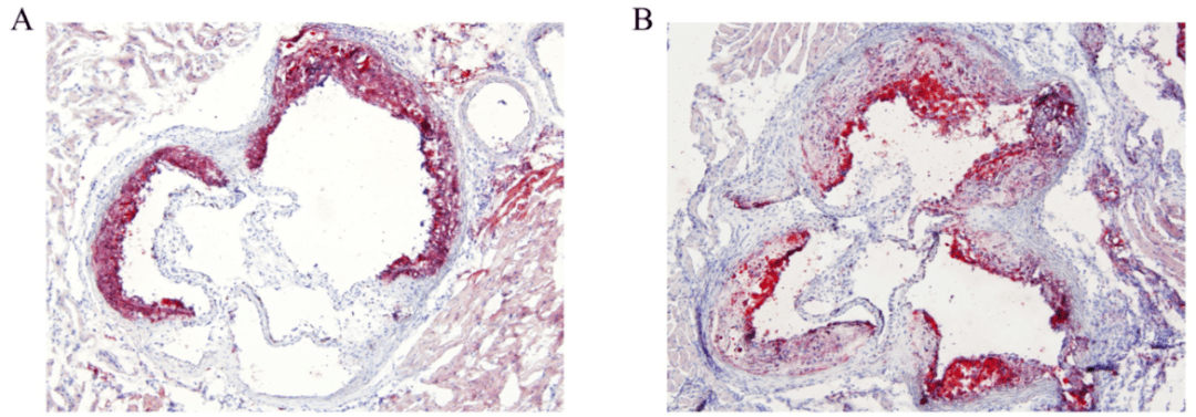 一文掌握小鼠動脈粥樣硬化斑塊定量評估