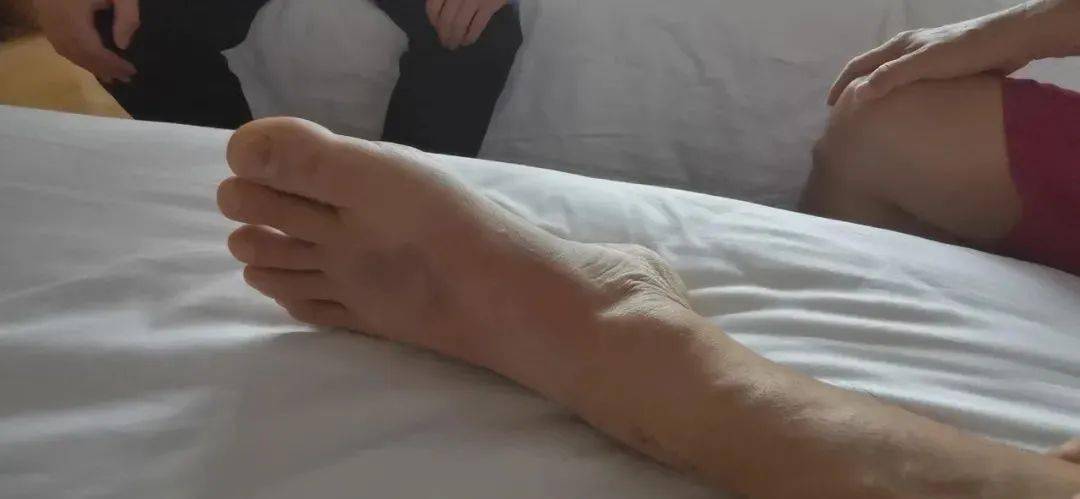 "过了好一阵子才缓过劲来,庞大伯说:"当时腿有点痛,他的腿上和脚上还