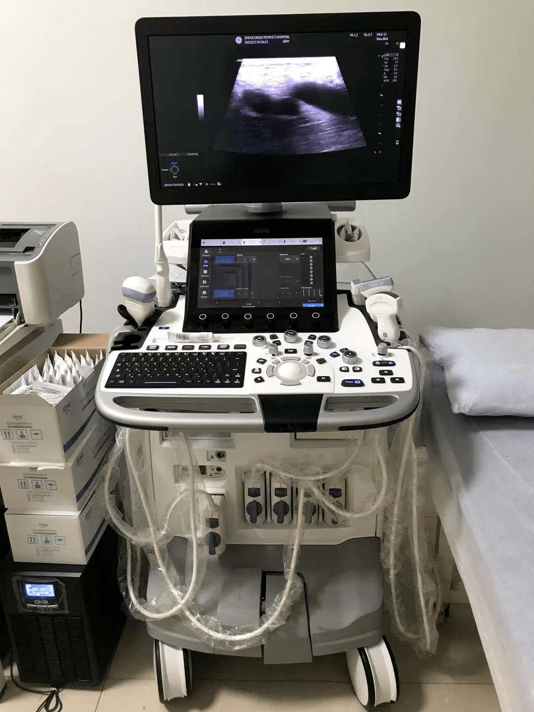 在家门口就能享受优质医疗资源啦省内领先超声设备落户周村区人民医院