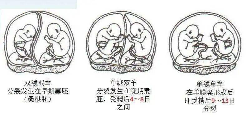 淄博市妇幼保健院:单卵or双卵双胎,你了解吗? 孕期双胎有哪些并发症?