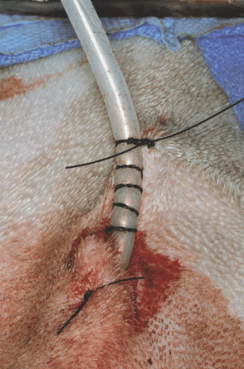 9用带针这一端在导管下方的皮肤上做第二针缝合(图63-5).