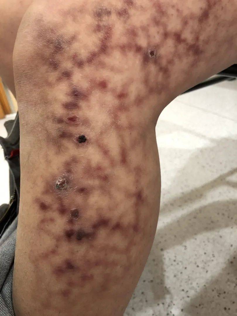 皮肤…,罪魁祸首竟然是它!最近丽水人还超爱用