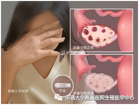 女性做试管婴儿会加速早衰吗