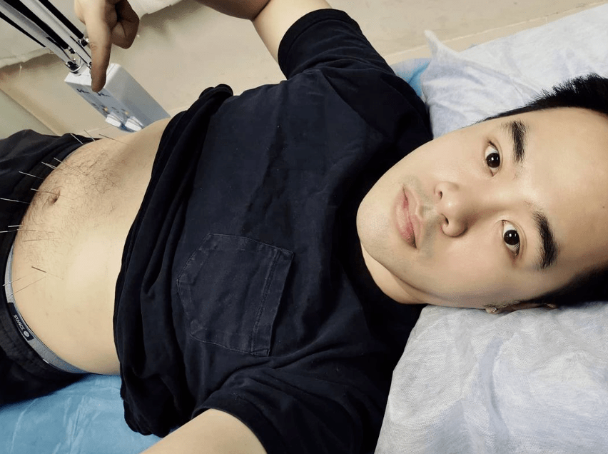 发文的同时,他还晒出一张躺在床上针灸肚皮的照片.