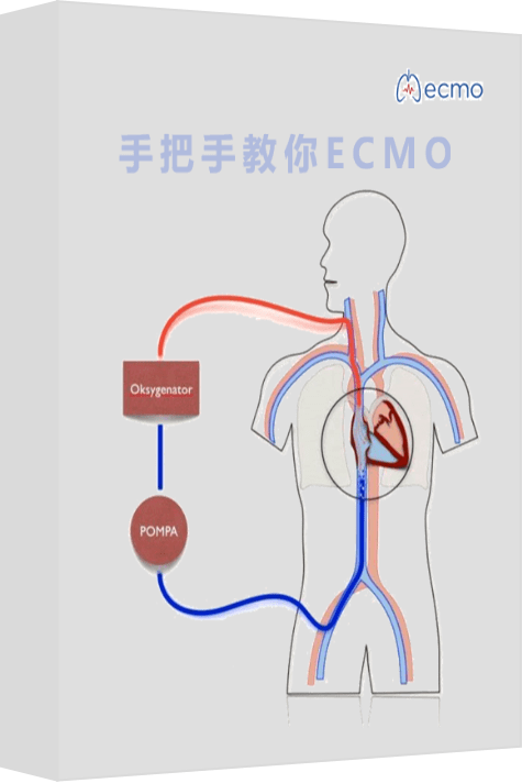 体外循环插管示意图图片